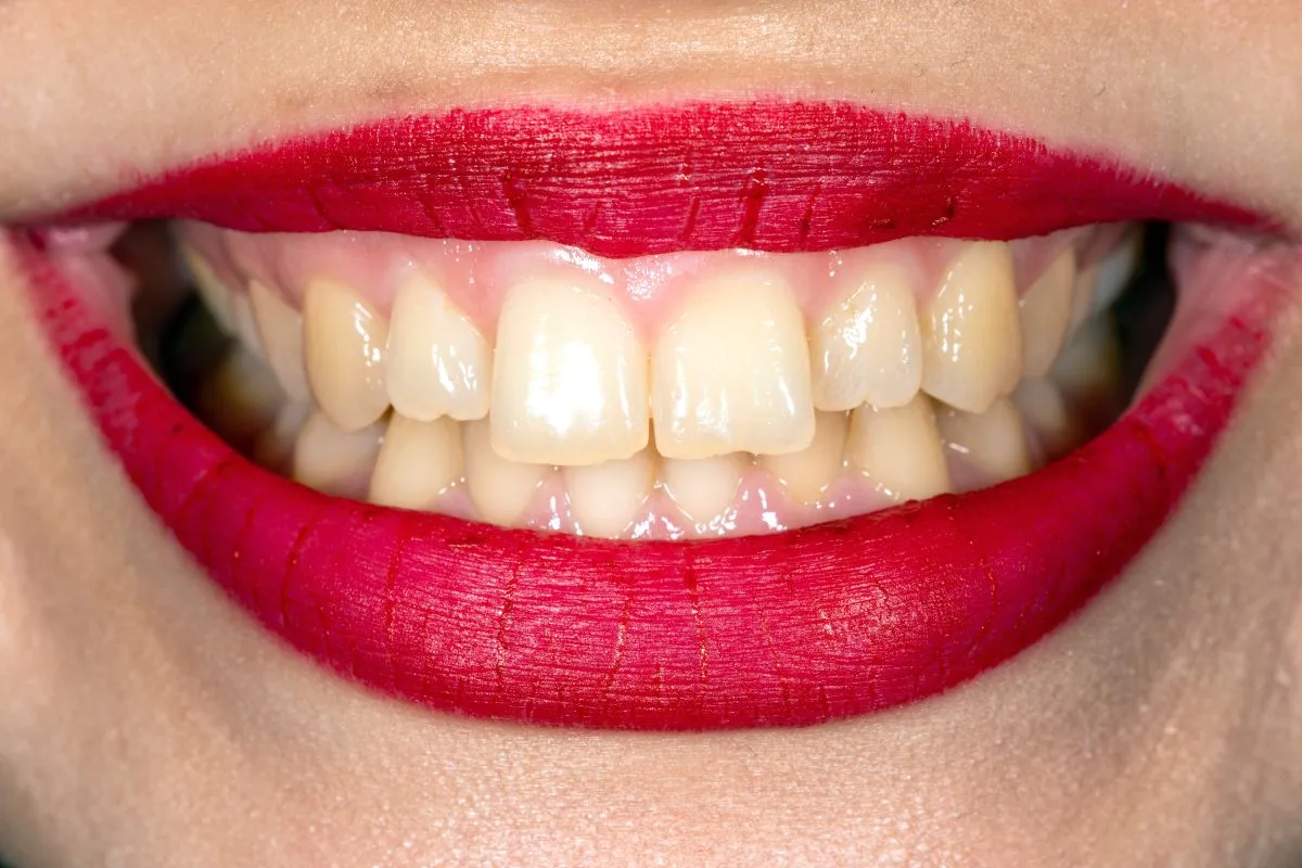 Makijaż permanentny ust i wybielanie zębów